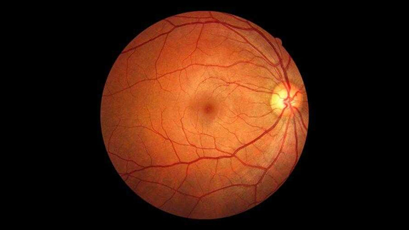 Retina Hastalıkları